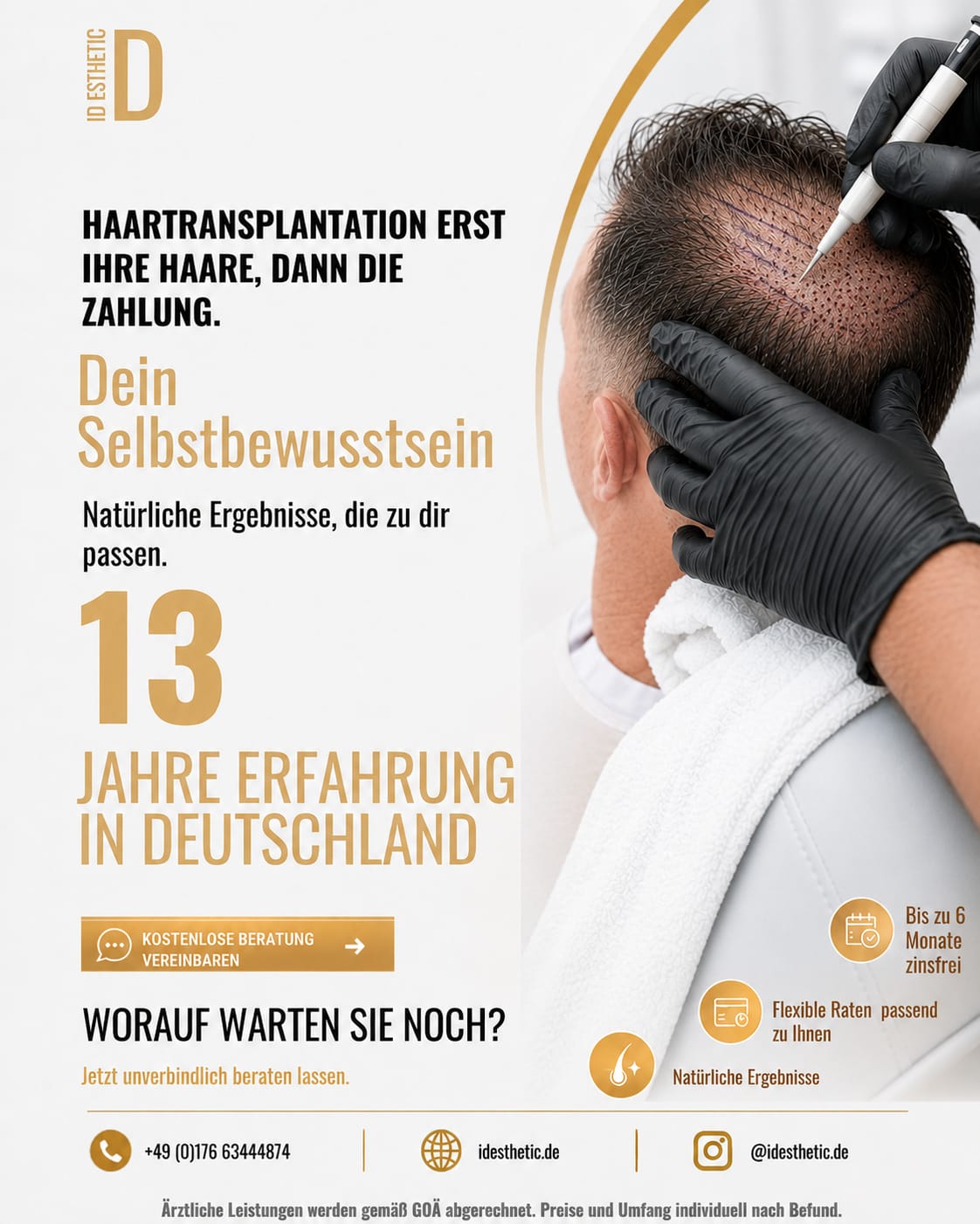 Haartransplantation mit bis zu sechs Monaten zinsfreier Finanzierung